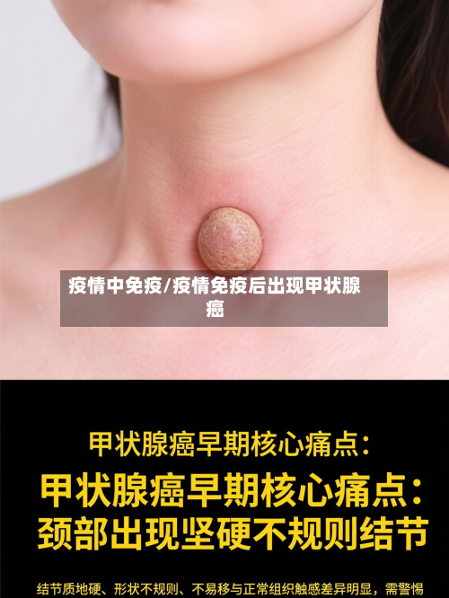 疫情中免疫/疫情免疫后出现甲状腺癌-第2张图片