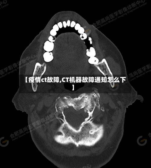 【疫情ct故障,CT机器故障通知怎么下】-第2张图片