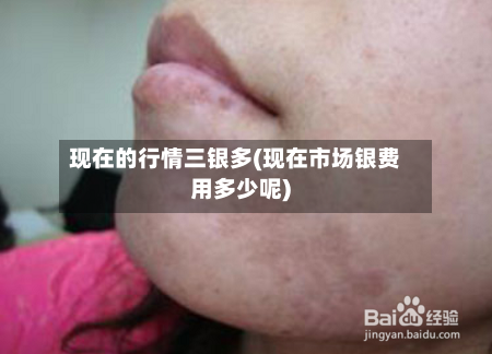 现在的行情三银多(现在市场银费用多少呢)-第2张图片