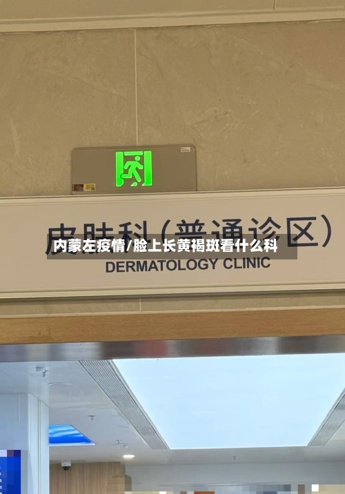 内蒙左疫情/脸上长黄褐斑看什么科