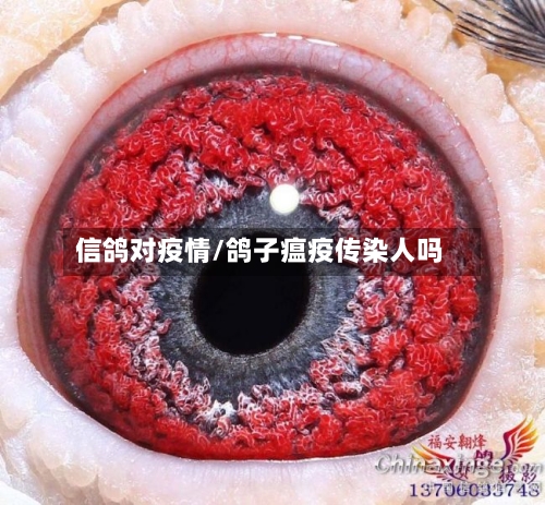 信鸽对疫情/鸽子瘟疫传染人吗