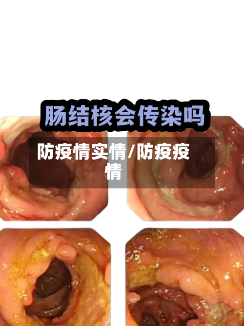 防疫情实情/防疫疫情-第2张图片