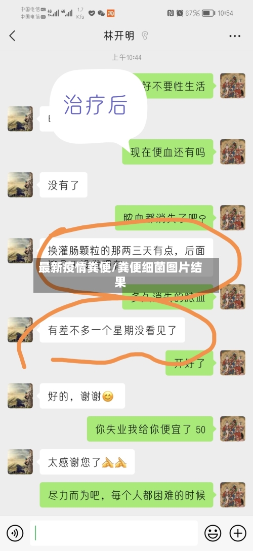 最新疫情粪便/粪便细菌图片结果