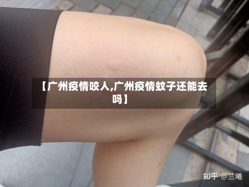 【广州疫情咬人,广州疫情蚊子还能去吗】