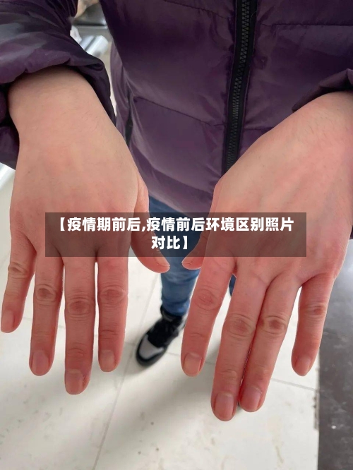 【疫情期前后,疫情前后环境区别照片对比】-第3张图片